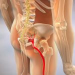 Who Can Help You Understand And Address Sciatica Pain?