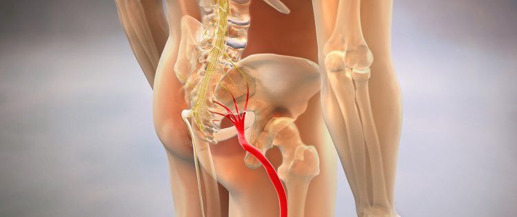 Who Can Help You Understand And Address Sciatica Pain?